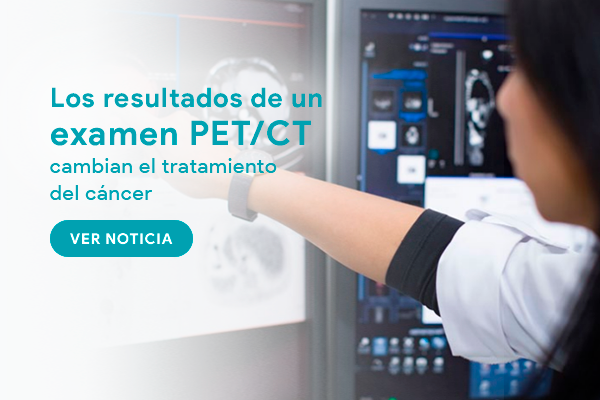 resultados pet ct cambian el tratamiento del cancer
