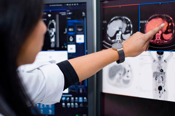 doctora indicando imagen pet ct